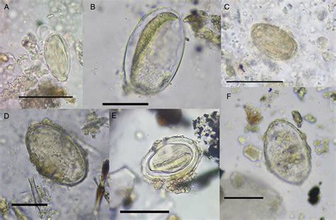 Helminth Eggs With Ambiguous Features A Gongylonematidae Gen Sp