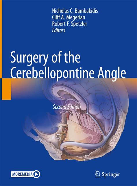 Buy Surgery Of The Cerebellopontine Angle Book Online At Low Prices In