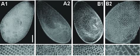 Infraciliary Lattice In Wild Type Cells And Mutant Cells Growing At