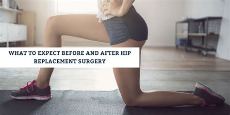 What To Expect Before And After Hip Replacement Surgery Comprehensive