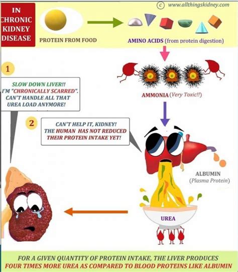 Renal Diet: General Guidelines - All Things Kidney ~ Official