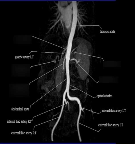 Abdominal Arteries Labeling Diagram Quizlet