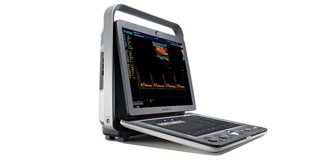 S Portable Color Doppler Sonoscape