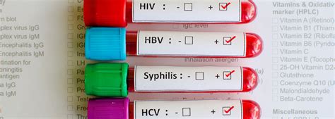 Sexually Transmitted Infections Stis Southwestern Public Health