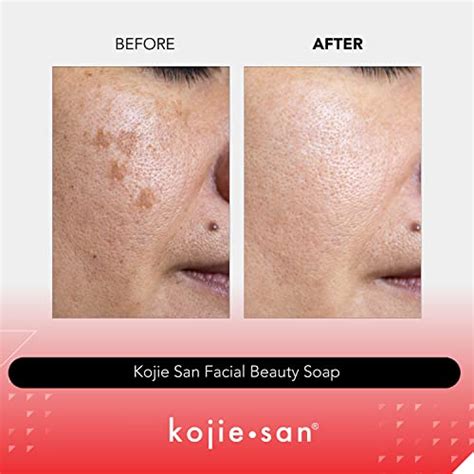 Kojie San Skin Brightening Soap Original Kojic Acid Soap For Dark