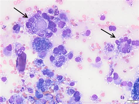 What Is Histiocytic Sarcoma Dogs