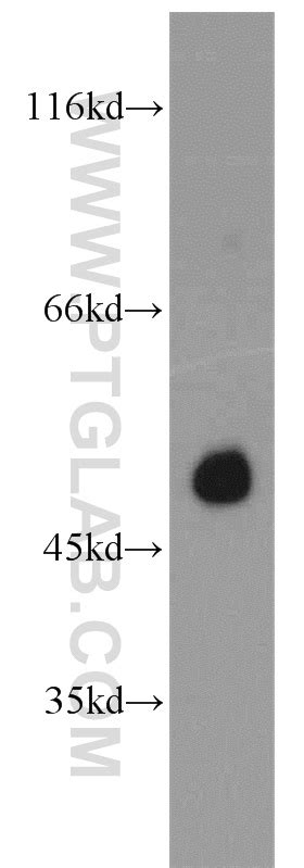 Pax6 Antibody 12323 1 Ap Proteintech 武汉三鹰生物技术有限公司