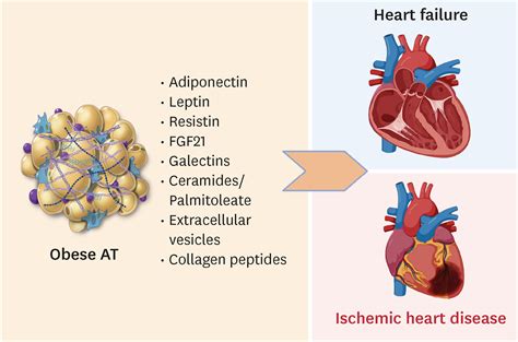 CMSJ CardioMetabolic Syndrome Journal