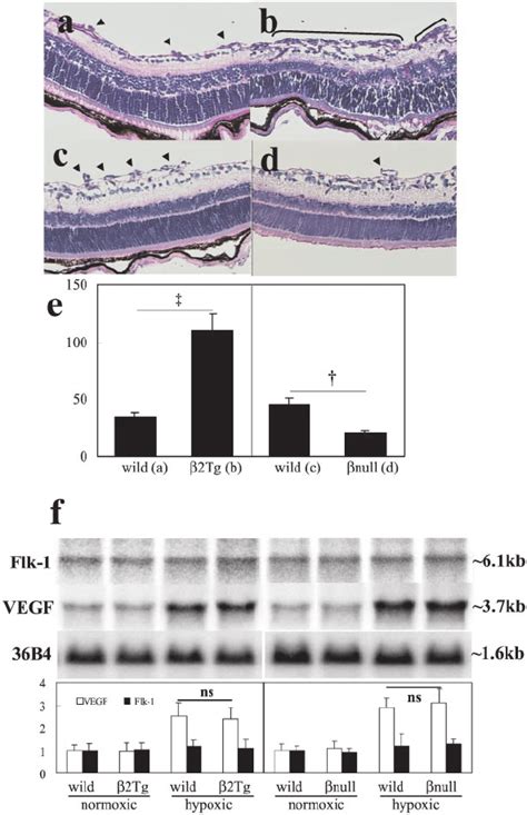 Cross Sectional Analysis Of Retina From A Wild Type And B Pkc ␤ Download Scientific