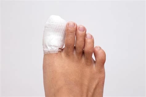 Ingrown Toenail Surgery At Well Heeled Podiatry In Hampton