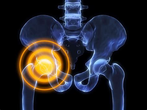 Osteoporosis vs. Osteopenia: What's the Difference? - Female Chiropractor Singapore