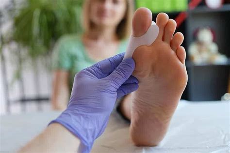 Convalescence Apr S Une Op Ration De Lhallux Valgus Dr Baudrier