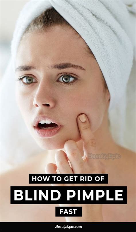 13 Easy Ways To Get Rid Of Blind Pimple Fast Skin Care Pimples Skin Care Masks Acne And