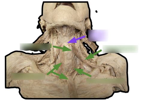 Infrahyoid Muscles Diagram Quizlet