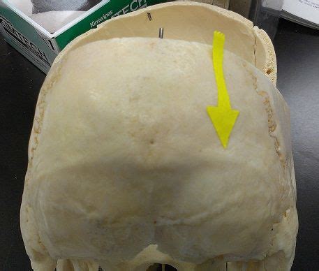 Axial Skeleton - posterior aspect of skull - Superior Nuchal Line | Axial skeleton, Axial, Food