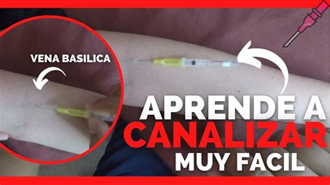 Como Canalizar Una Vena En El Brazo En Minuto Venoclisis