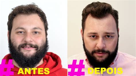 Top 8 Melhores Tipos De Barba Para Rosto Redondo Como Ter Barba