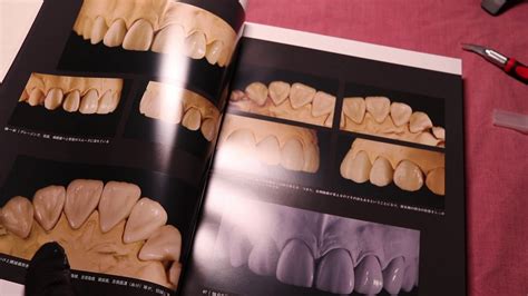 The Ultimate Guide To Tooth Morphology 2 Advance Youtube