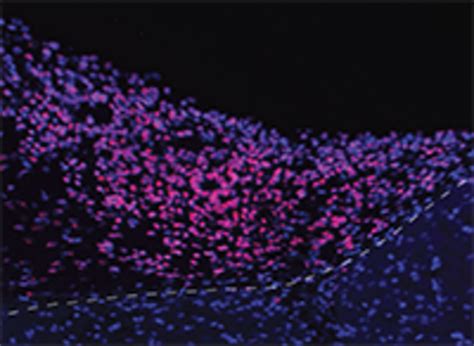 Border Between A Transplanted [image] Eurekalert Science News Releases