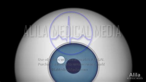 Alila Medical Media Video Galleries By Anatomical Systems