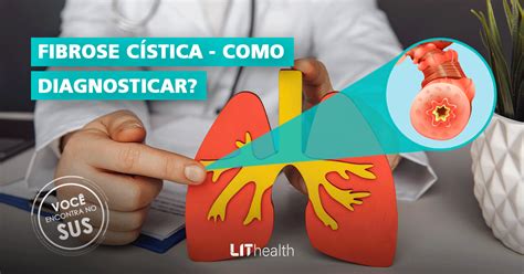 Fibrose Cística Como Diagnosticar Lithealth