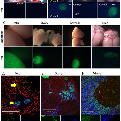 Bright Field And Epifluorescence Localisation Of Yfp Expression In