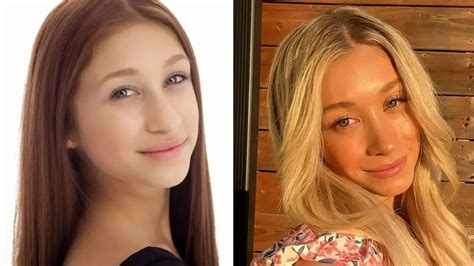 Briar Nolets Nose Job Before And After Photos Celebs In Depth