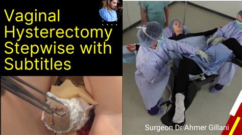 Vaginal Hysterectomy Hd Video All Steps Well Demarcated And Performed In Crisp And Clear Way