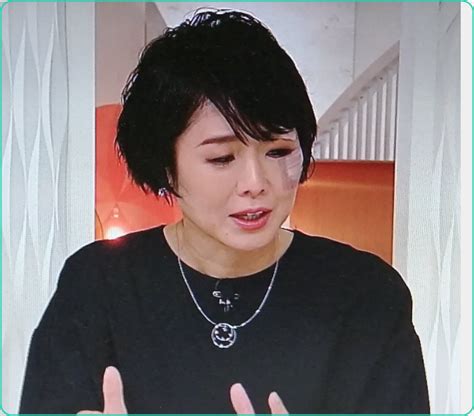 【画像】有働由美子アナが大怪我で顔面絆創膏！理由は酔って階段から転落？ Sparkle