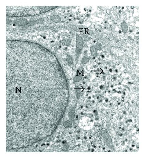 Ultrastructural Immunocytochemistry Of The AT 1 A Receptor Using Anti