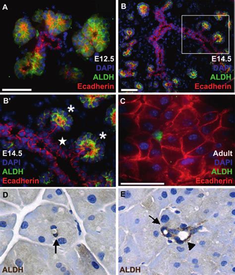 Aldh1 Expression In Embryonic And Adult Mouse Pancreas Ac