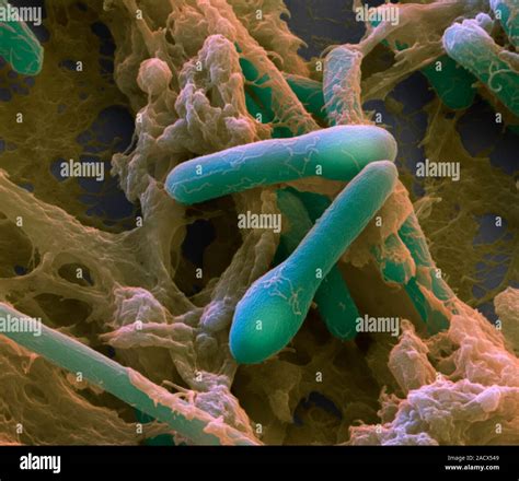 La Bacteria Clostridium Botulinum Color Análisis Micrografía De