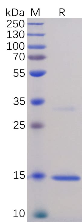 Human Tnfa Protein His Tag