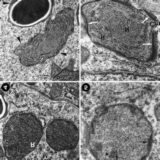 Diagram Of The Mature Spore Of Microsporidium Epithelialis Sp N