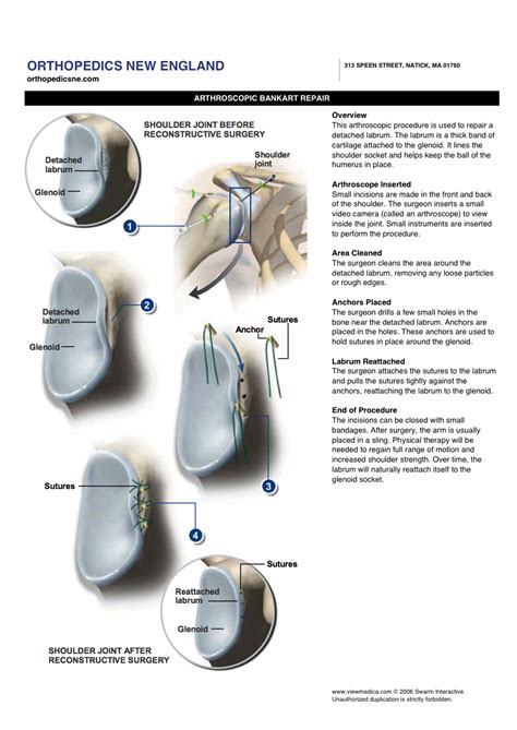 Shoulder Instability | 321GOMD