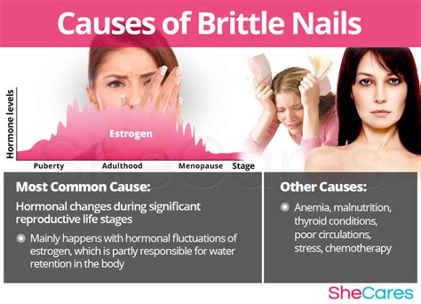 Brittle Nails Shecares