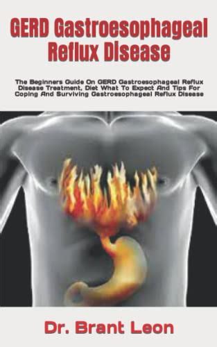 Gerd Gastroesophageal Reflux Disease The Beginners Guide On Gerd