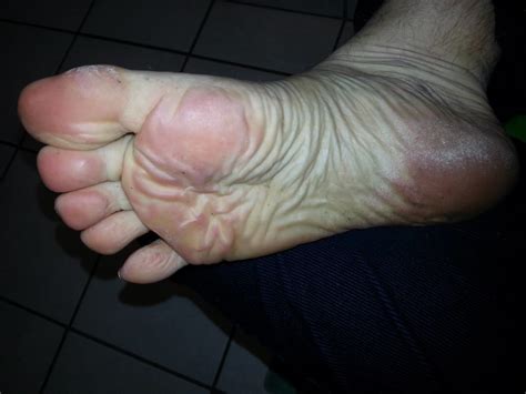 Feet Soles Ass For You Pics Xhamster