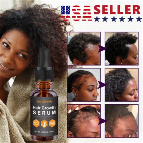 Allurium Beauty Hair Growth Serum Black Women Anti Hair Loss Nourish