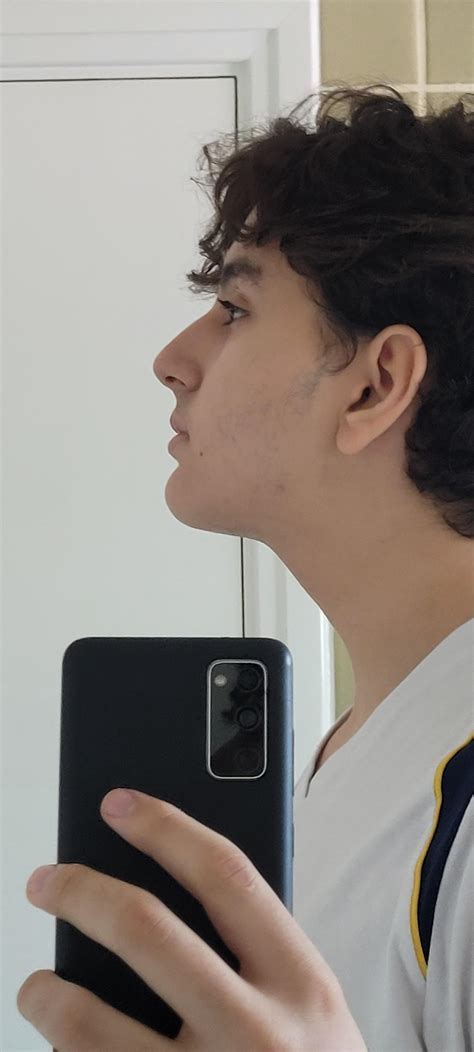Do I Have A Recessed Jawline I Have 20 Of Body Fat And A Lot At The