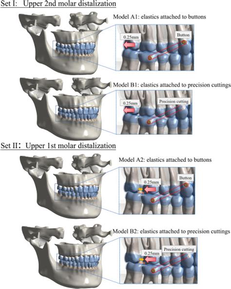 Actual Contribution Ratio Of Maxillary And Mandibular Molars For Total