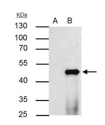 Ppar Alpha Nr C Antibody Nbp Novus Biologicals