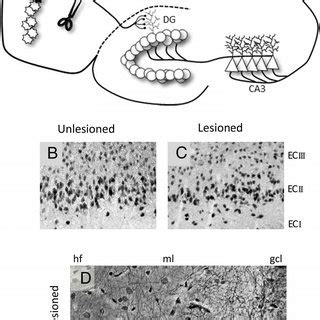 Unilateral entorhinal cortex lesion model. A, Schematic representation ...