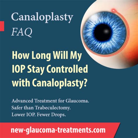 How Long Will My Iop Stay Controlled With Canaloplasty New Glaucoma