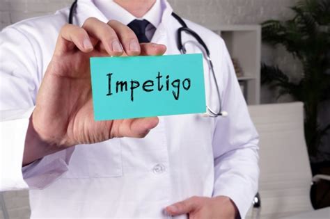 Informatii Despre Impetigo Cauze Si Tratament