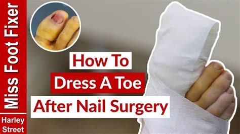 How To Bandage A Toe After Surgery By Miss Foot Fixer Youtube