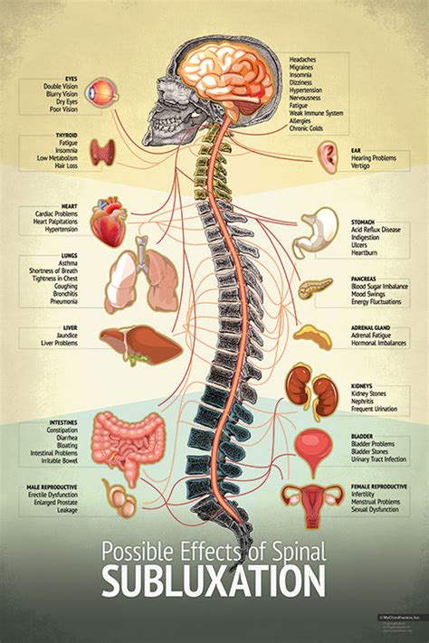 "Subluxation" Spine Chart – Chiropractic BioPhysics