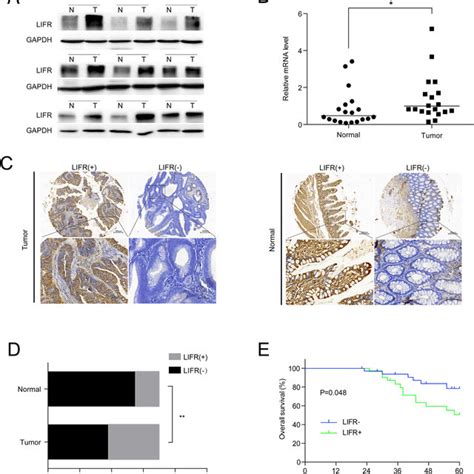 Alteration Of Angiogenesis Related Gene Expression With Lifr Silencing