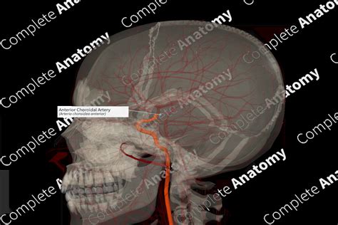 Anterior Choroidal Artery (Right) | Complete Anatomy