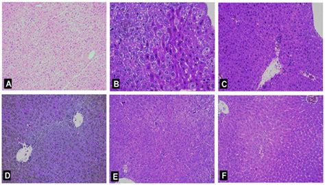 Histological Analysis Of The Livers After Con A Administration Typical